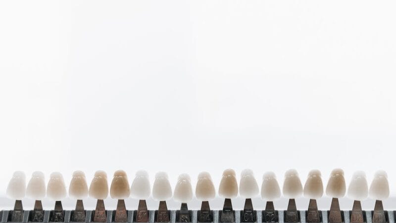 How to Get Natural-Looking Smiles with Custom Veneers