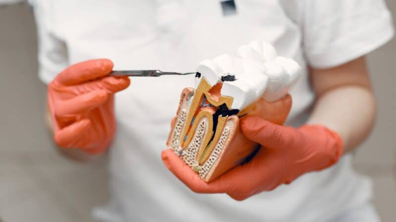 Tooth Decay Is Now NSW’s Top Cause of Preventable Hospital Stays, and the Bill Is Climbing
